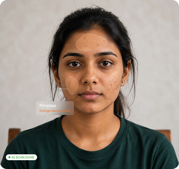 Rupam AI detecting pimples on a facial scan